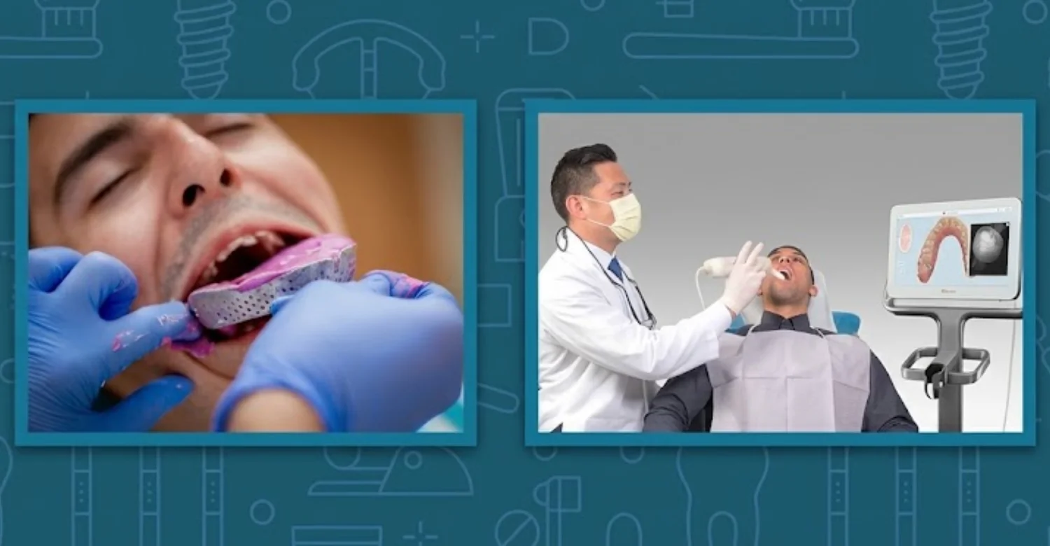 Digital vs Conventional Impressions for Implant Crowns 2